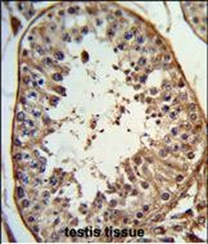 ANGEL1 Antibody (C-term)