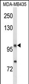 NRP1 Antibody (C-term)