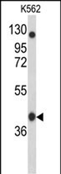 APOBEC3F Antibody (N-term)