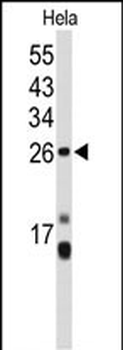CENPH Antibody (Center)