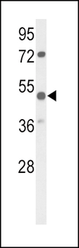 PARVA Antibody (C-term)