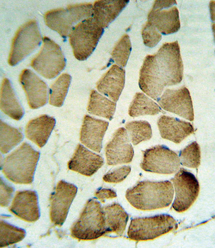 PARVA Antibody (C-term)
