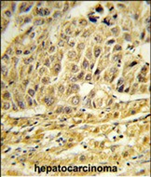 CCNB1IP1 Antibody (C-term)