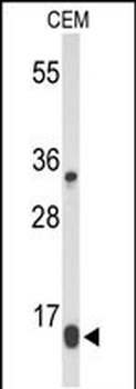DIRAS1 Antibody (Center)