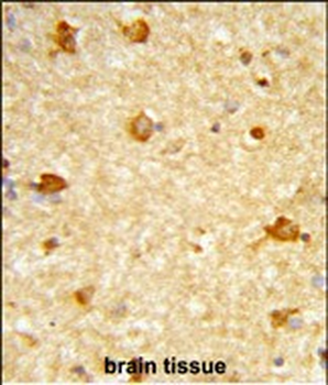 DIRAS1 Antibody (Center)