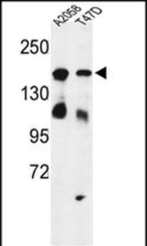 HDLBP Antibody (Center)