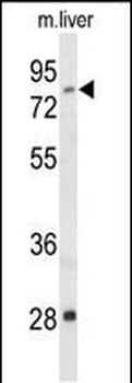 ACSS2 Antibody (N-term)