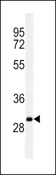 C19orf18 Antibody (Center)