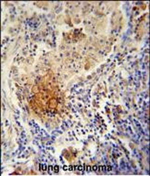 TYROBP Antibody (C-term)
