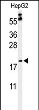 PXMP2 Antibody (Center)