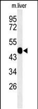 WAS Antibody (Center)