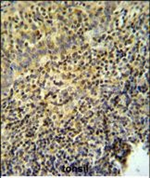 WAS Antibody (Center)