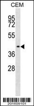 IHH Antibody (C-term) (Ascites)