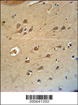 DLG4 Antibody (C-term) (Rat) (Ascites)