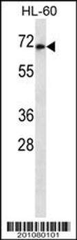 HIPK4 Antibody (ascites)