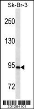 PGR/PR Antibody (Ascites)
