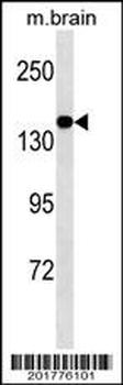 MED14 Antibody (Ascites)