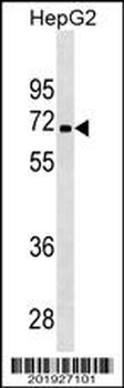 PDK3 Antibody (Ascites)