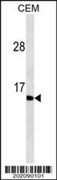 GAST Antibody(Ascites)