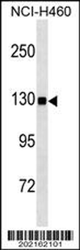 USP8 Antibody (C-term C1072) (Ascites)