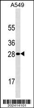 HPRT1 Antibody(Ascites)