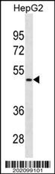 AMBP Antibody (N-term) (Ascites)