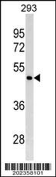 GATA4 Antibody (C-term) (Ascites)