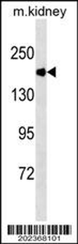 ACE Antibody (Ascites)