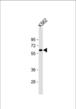 CAT Antibody (Center) (Ascites)