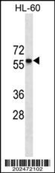 CCR7 Antibody (N-term) (Ascites)