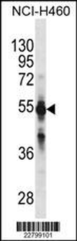 CYP2C9 Antibody (N-term) (Ascites)