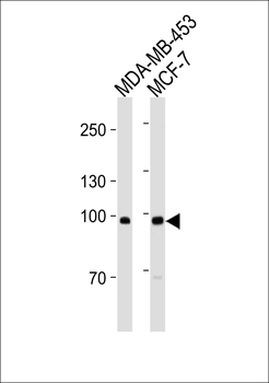 ACE2 (NCOVID / SARS Receptor) Antibody (Center)(Ascites)