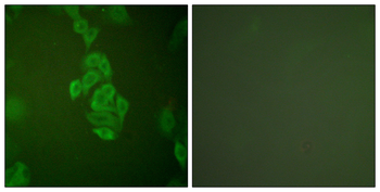 NSE Antibody