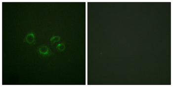 EPHA2/3/4 Antibody (Ab-588/596)