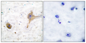 GABA-B Receptor Antibody