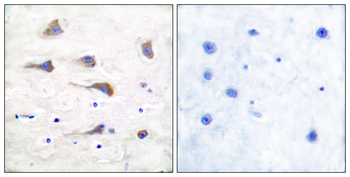 mGluR6 Antibody