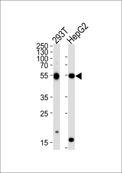 PHKG1 Antibody