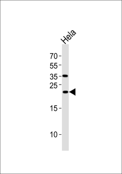 UBE2T Antibody