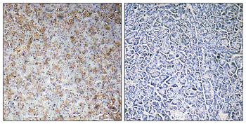 WASF2 Antibody