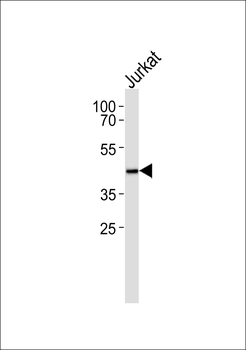 PEX10 Antibody
