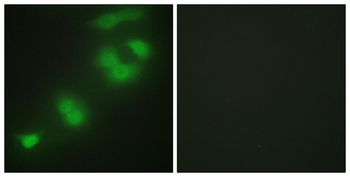 CREBZF Antibody