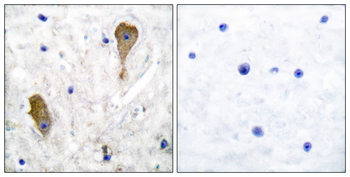 GAD1 Antibody