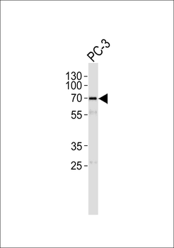 CSTF2T Antibody