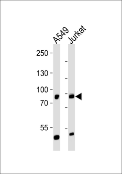 PNPLA8 Antibody