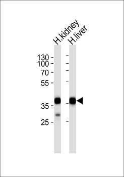ALDOB Antibody