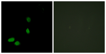 HMG17 Antibody
