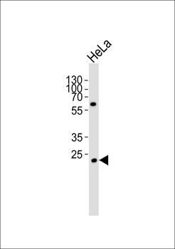 NDUFV2 Antibody