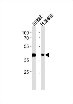 CATL2 (Cleaved-Leu114) Antibody
