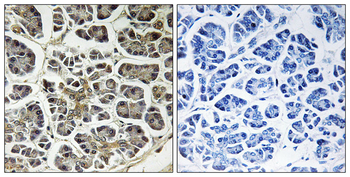 ATP5G2 Antibody