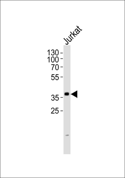 TSTA3 Antibody